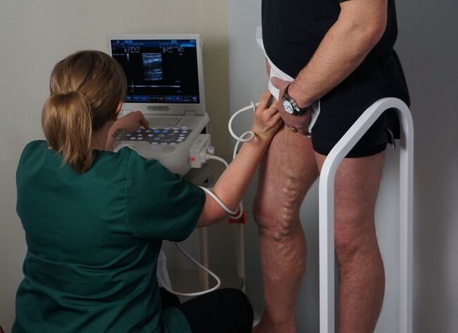 изследване на вените преди лазерна коагулация за разширени вени